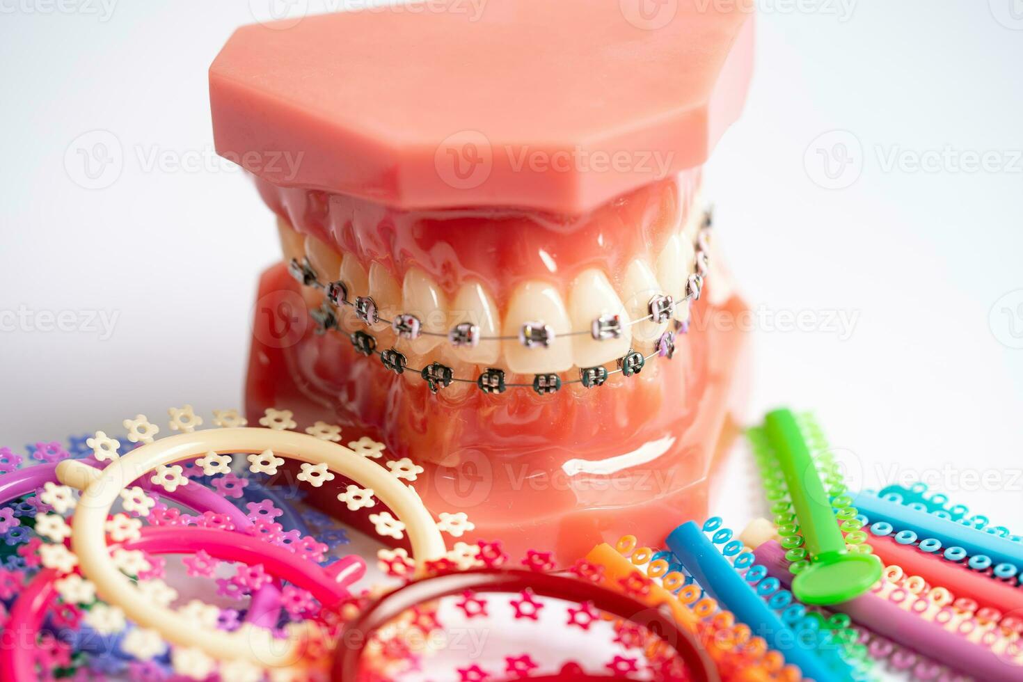 Orthodontic ligatures rings and ties, elastic rubber bands on orthodontic braces, model for dentist studying about dentistry. photo