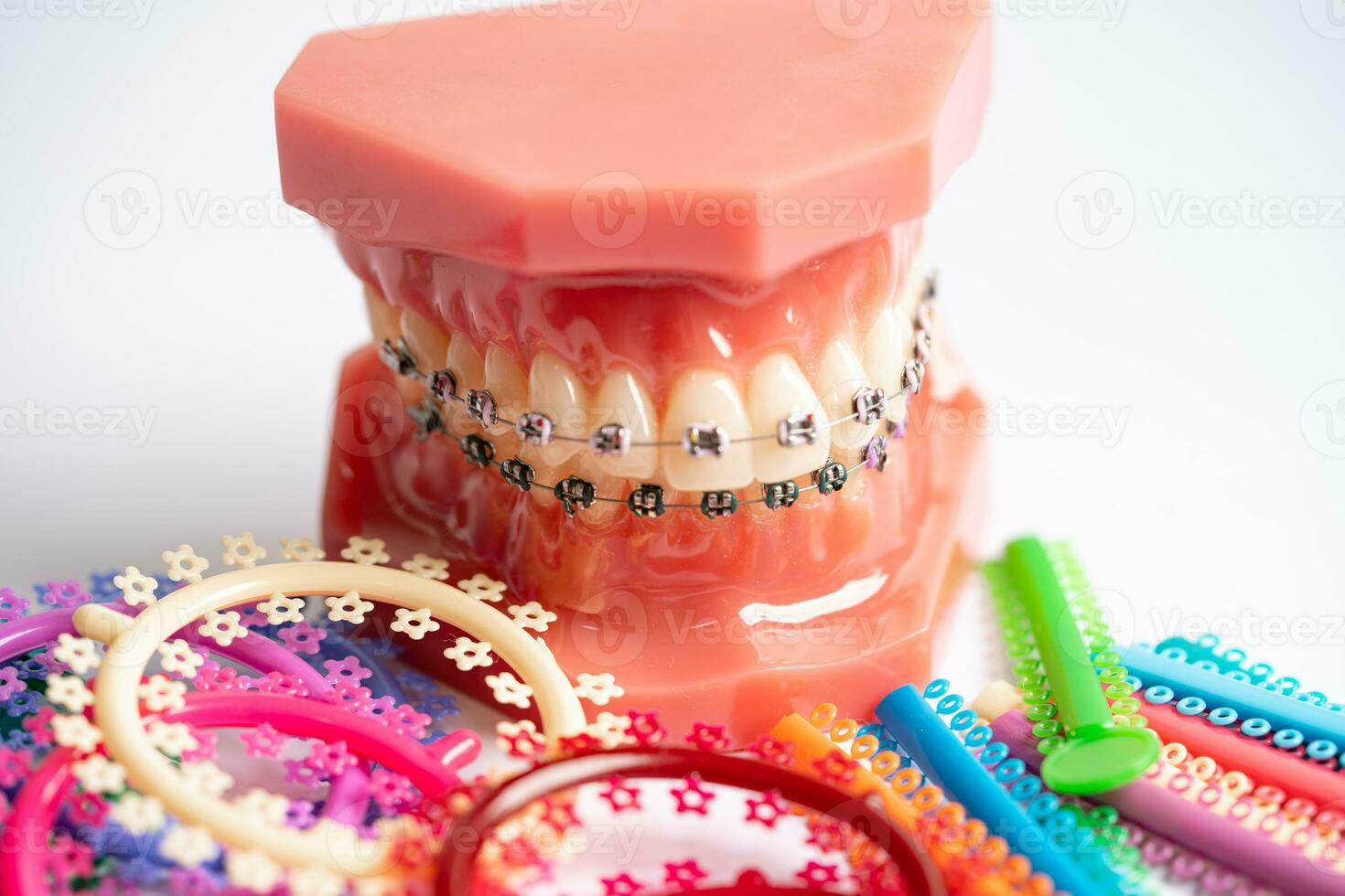 Orthodontic ligatures rings and ties, elastic rubber bands on orthodontic  braces, model for dentist studying about dentistry. 33303149 Stock Photo at  Vecteezy