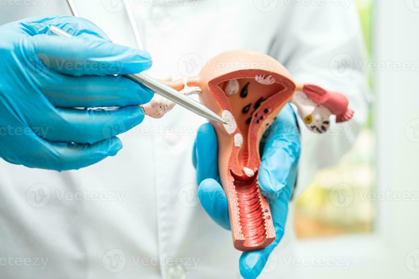 Uterus, doctor holding anatomy model for study diagnosis and treatment in hospital. photo