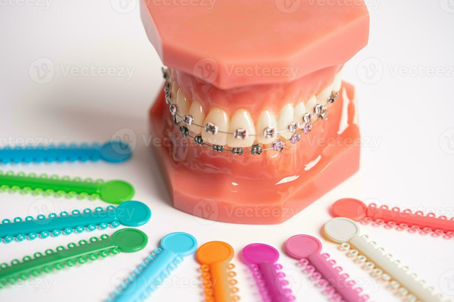 Orthodontic ligatures rings and ties, elastic rubber bands on orthodontic braces, model for dentist studying about dentistry. photo