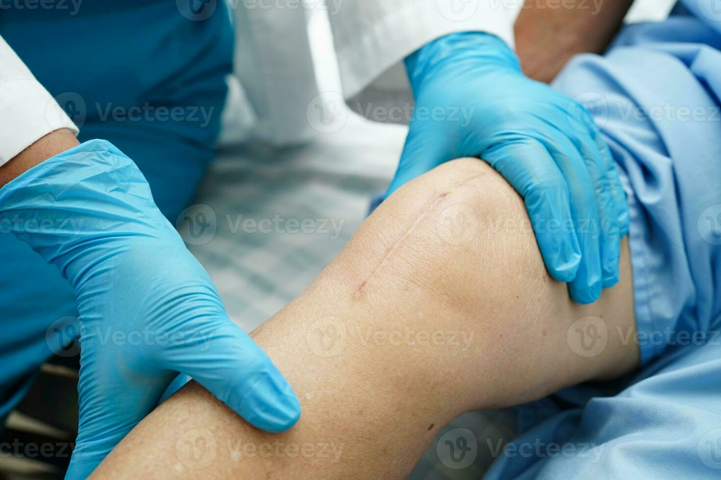 Doctor checking Asian elderly woman patient with scar knee replacement surgery in hospital. photo