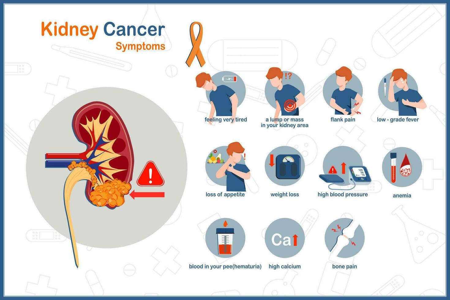 síntomas de riñón cáncer vector