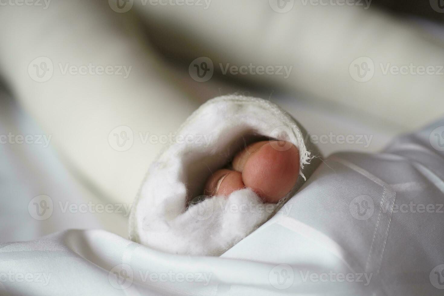 little child with plaster bandage on leg. photo