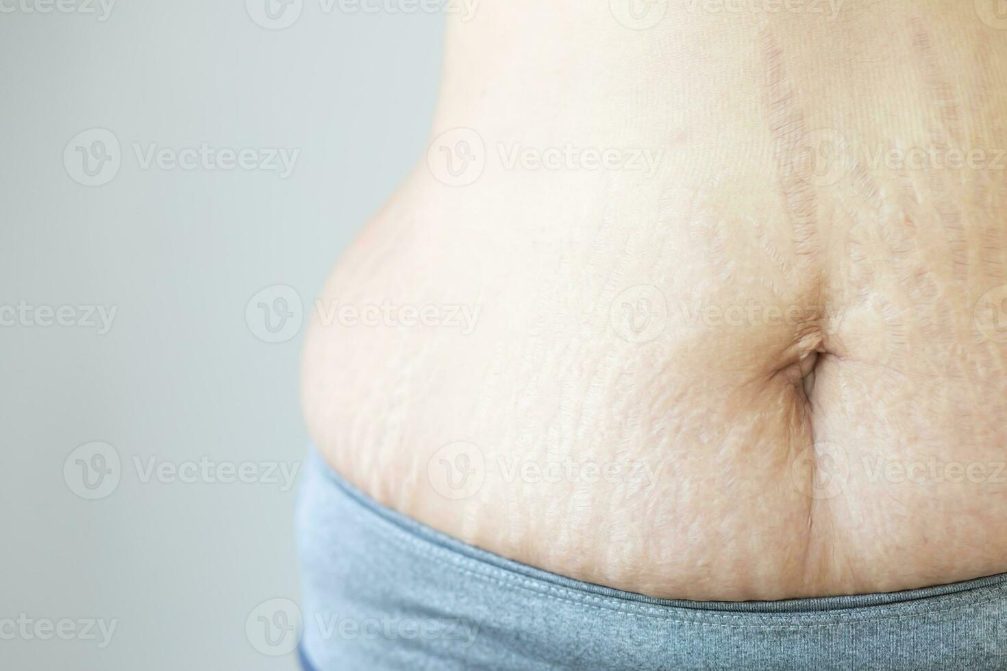 Fat woman with excess fat photo
