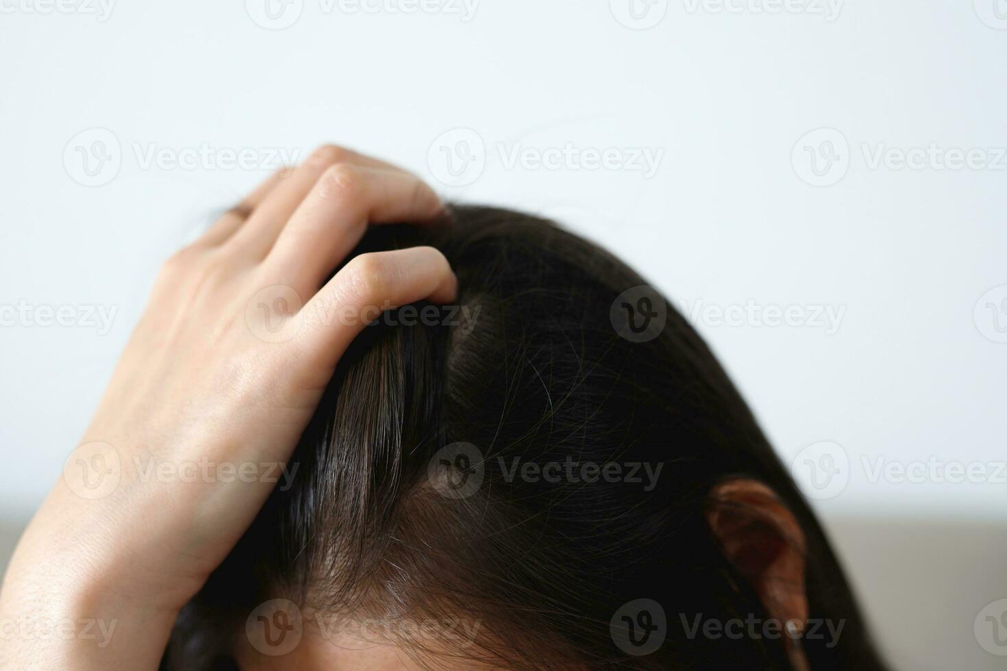 A woman has problems with hair and scalp,she has dandruff from allergic reactions to shampoos. and hair conditioner photo
