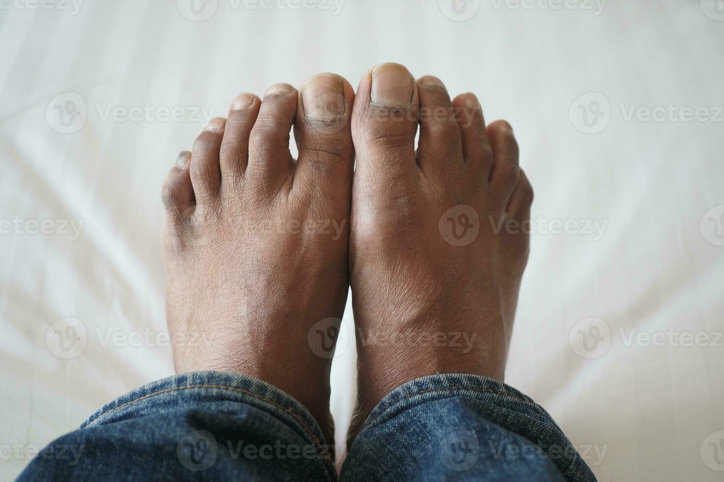 close up of young men dry feet on bed photo