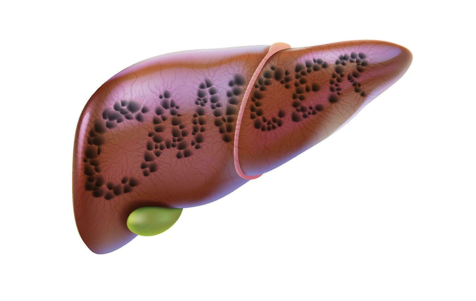 3D illustration of the liver and gallbladder with the word cancer presented for quick understanding. vector