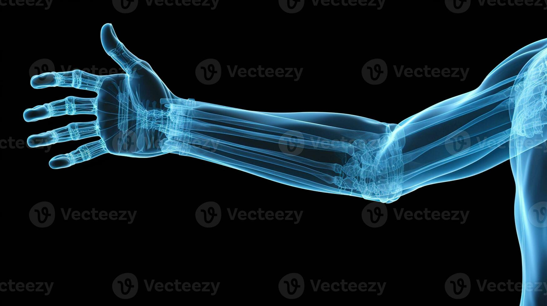 Orthopedic Excellence, Detailed X-Ray of a Male Human Arm in Blue Tones on a Black Background - Ideal for Precise Medical Imaging and Diagnosis, Ai generative photo