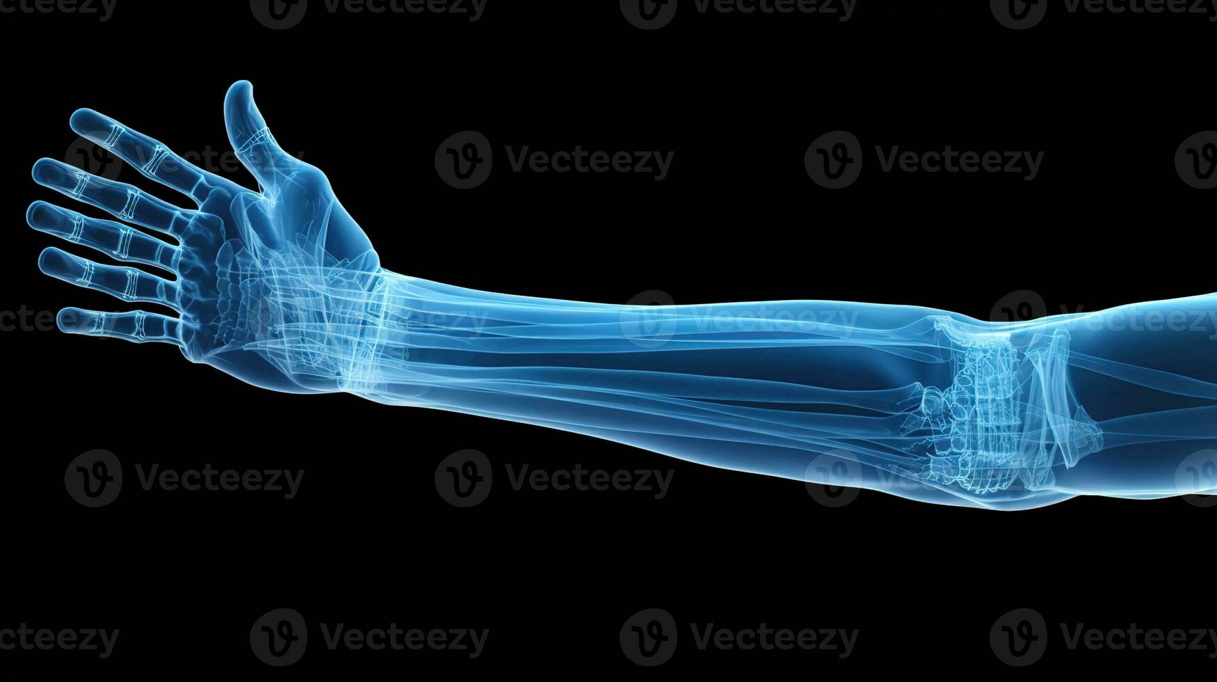 ortopédico excelencia, detallado radiografía de un masculino humano brazo en azul tonos en un negro antecedentes - ideal para preciso médico imagen y diagnóstico, ai generativo foto