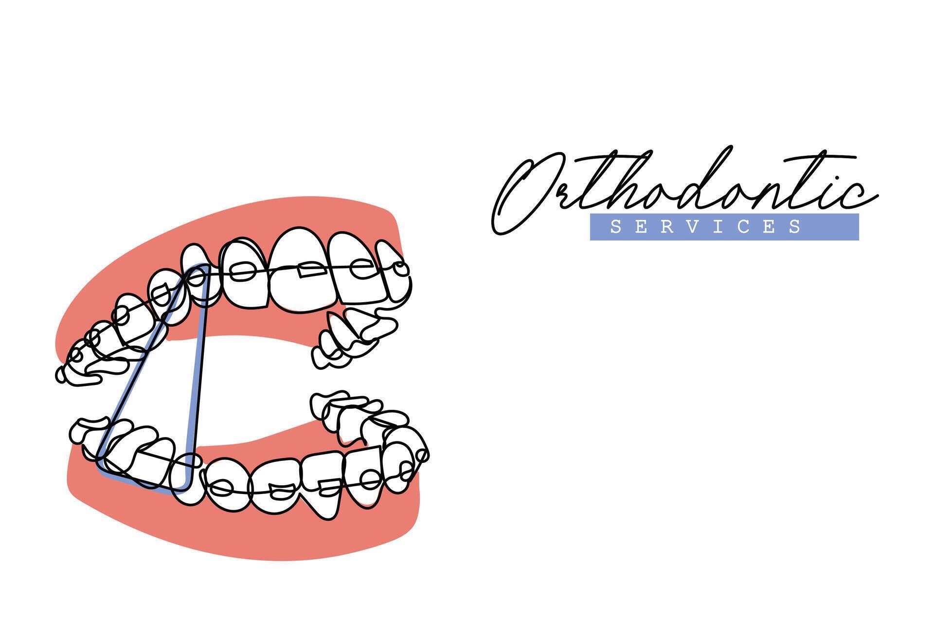 Continuous line art of Orthodontic treatment. Dentists day and respect