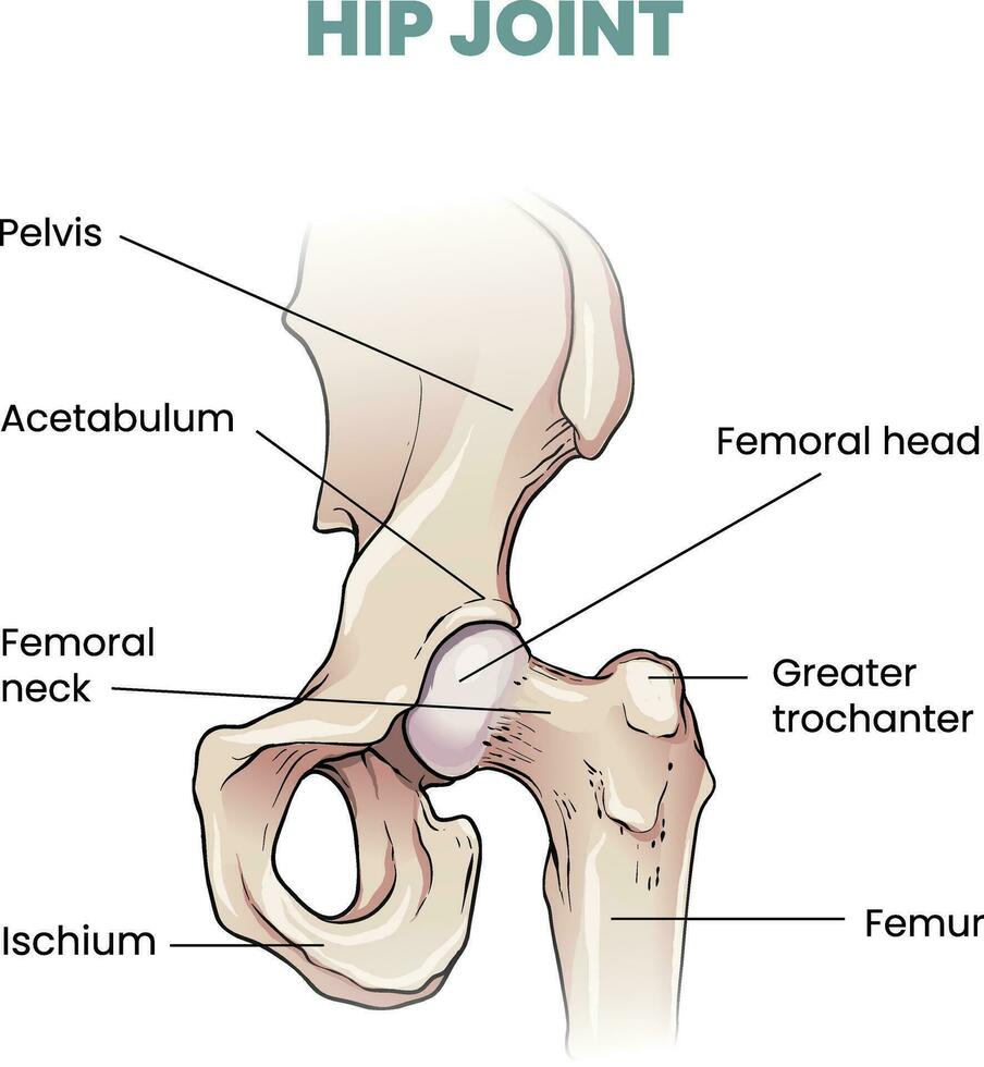 illustration of Hip joint infographic vector