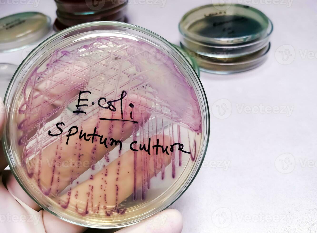 Microbiologist holding petri dish for Sputum culture test showing a colony of E. coli bacterium. photo
