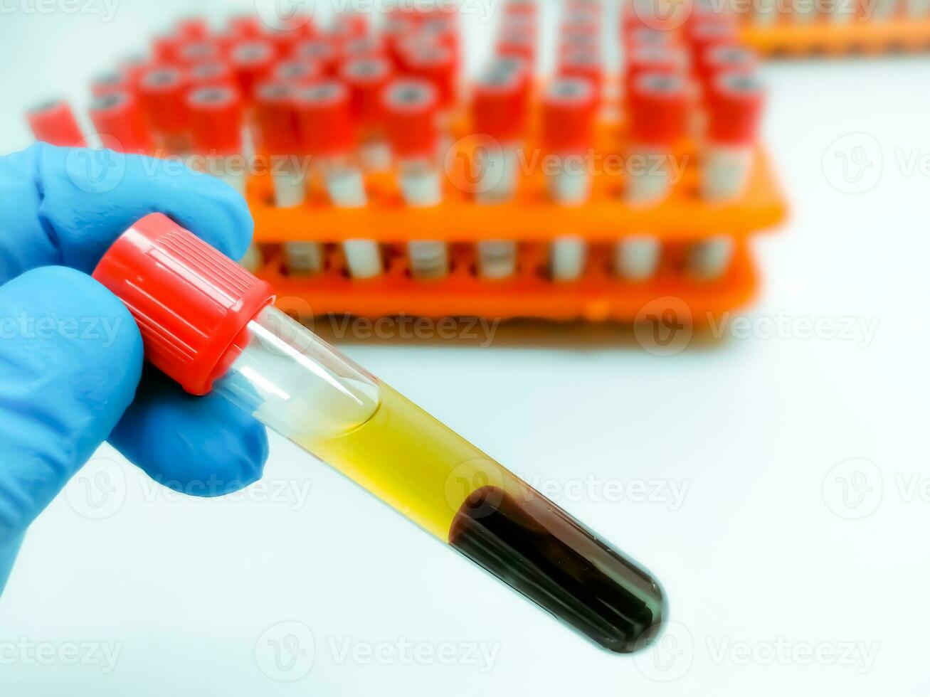 Technologist hold Serum sample tube with blood sample for medical testing in laboratory. photo