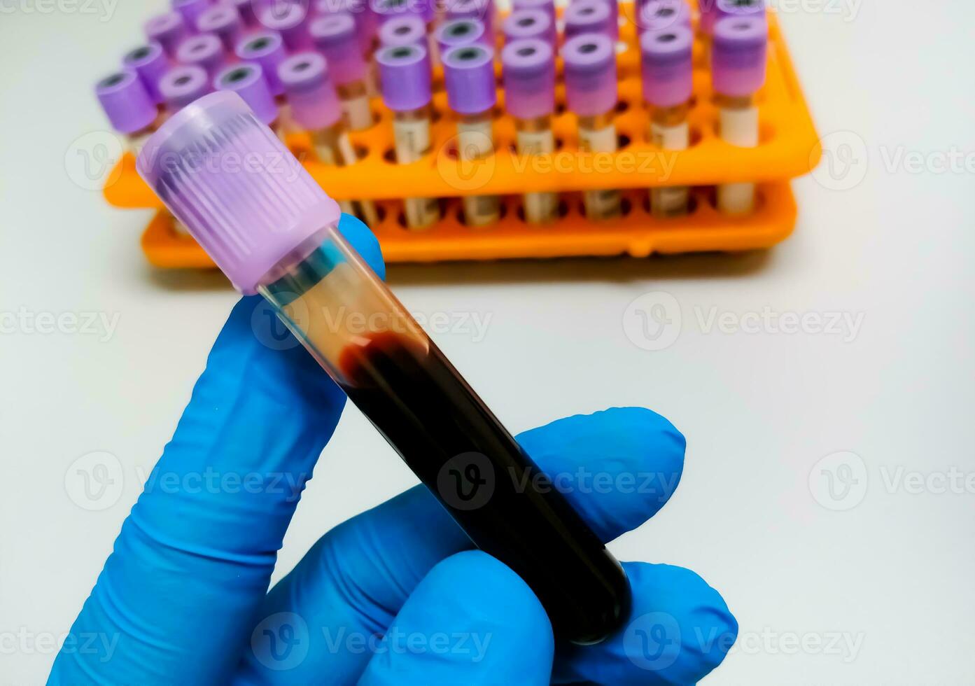 Technologist holding levender or whole blood eDTA tube with blood sample for medical testing in laboratory. photo