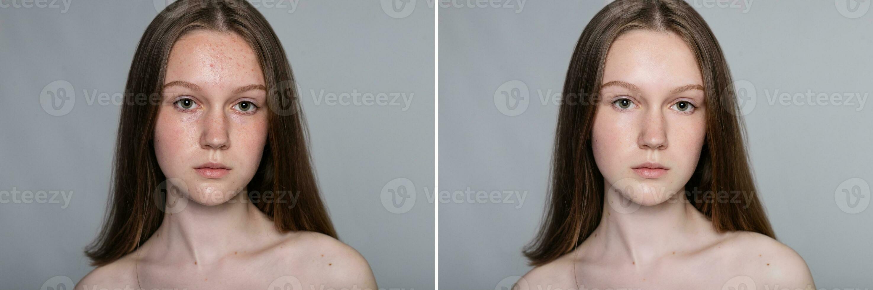 antes de y después cosmético operación. joven bonito mujer retrato foto