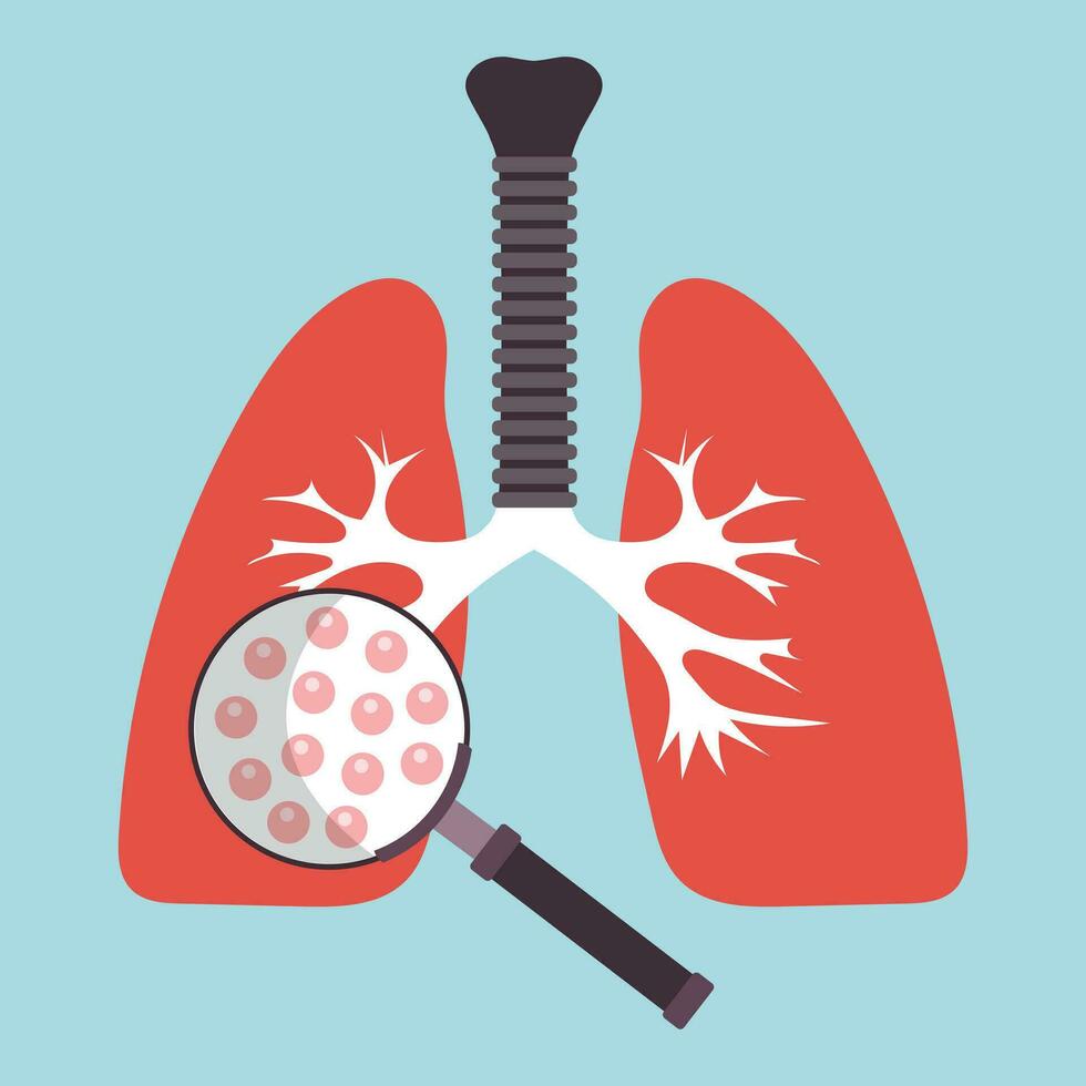 Human lungs with hand holding magnifying glass showing viruses and bacteria. Respiratory diseases concept. Flat vector illustration