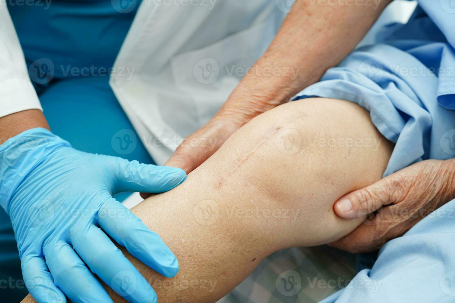 Doctor checking Asian elderly woman patient with scar knee replacement surgery in hospital. photo