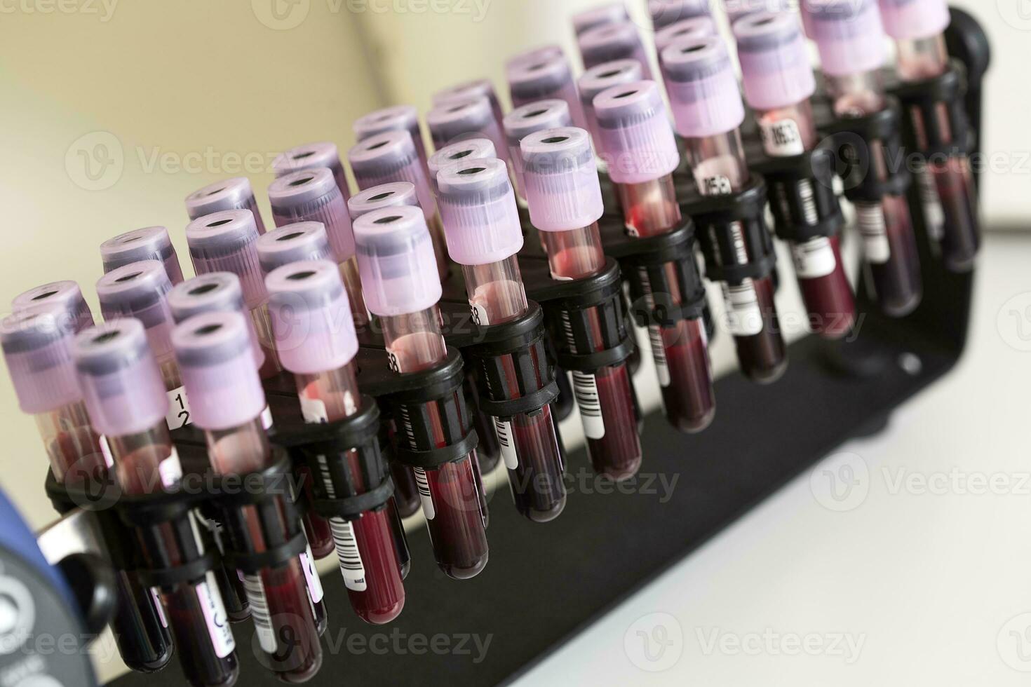 Tube blood sample in a medical examination. photo