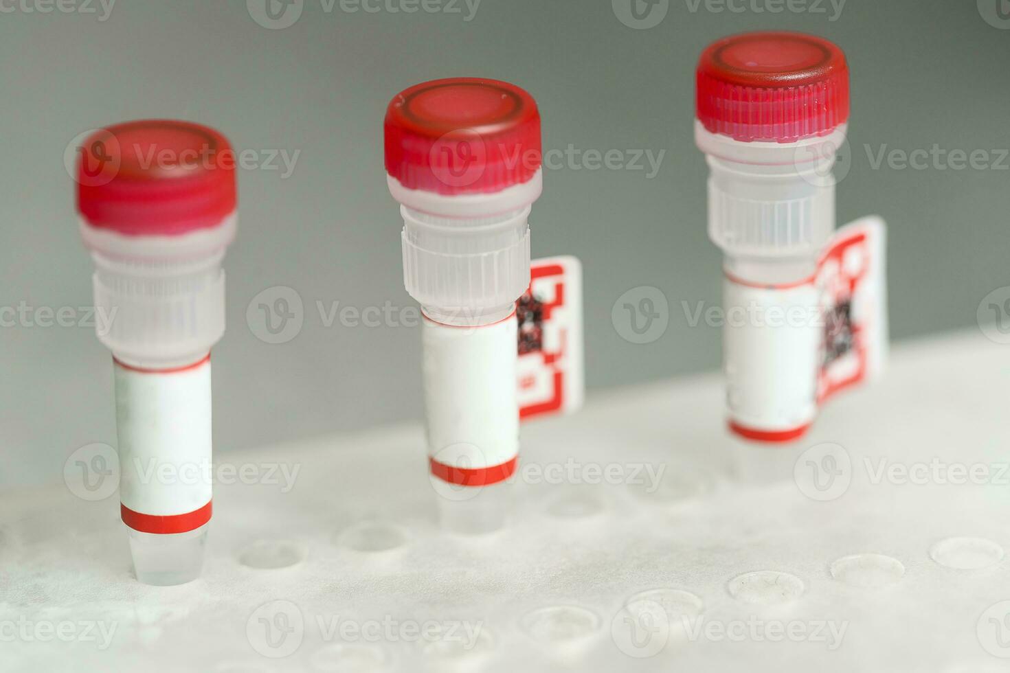 Test tubes arranged on medical trolley photo