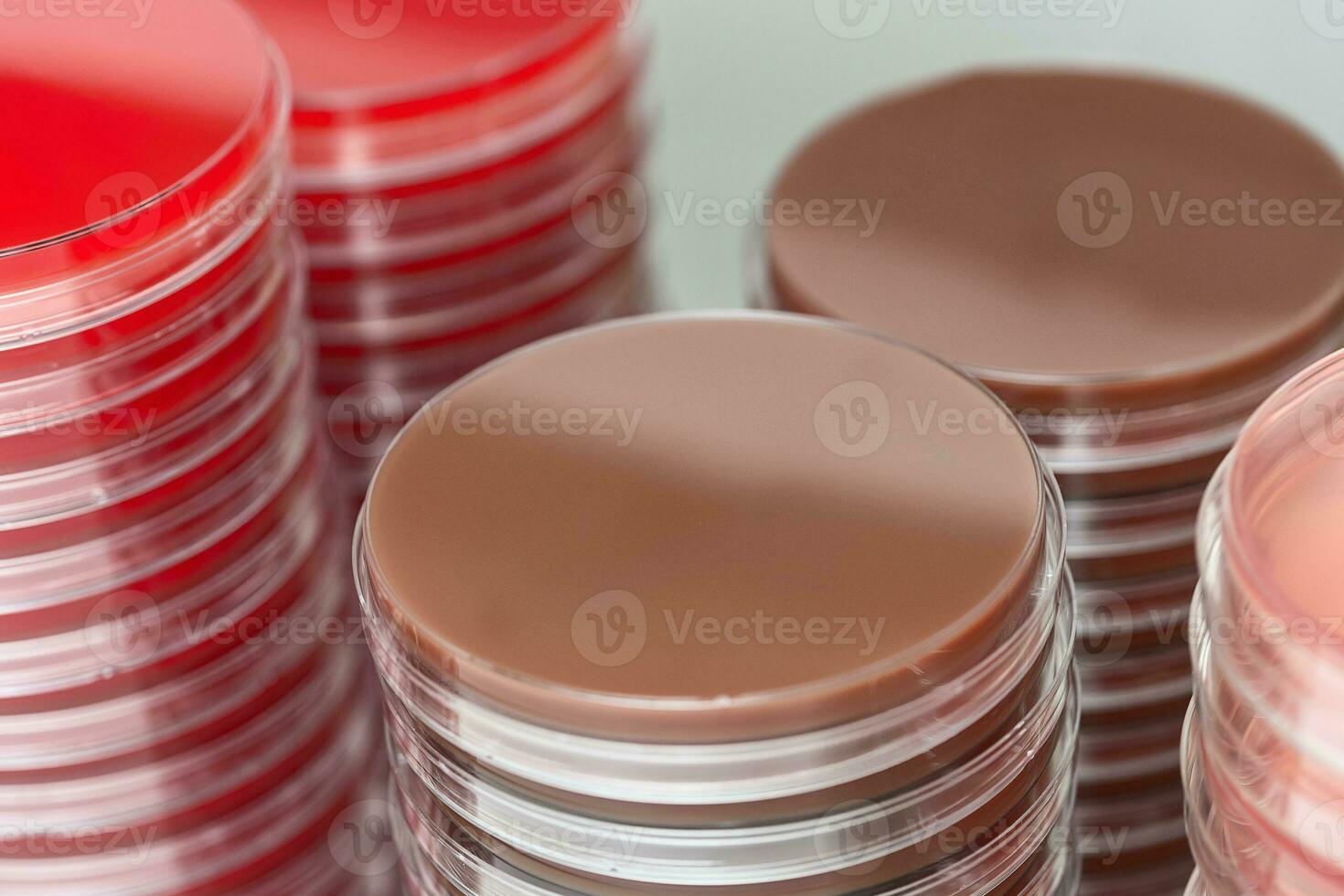 Red and brown petri dishes stacks in microbiology lab. Focus on stacks. photo