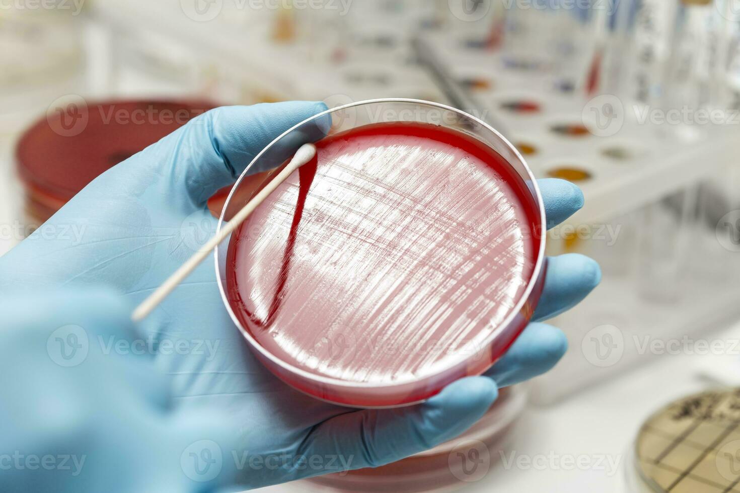 lab technician hand planting a petri dish photo