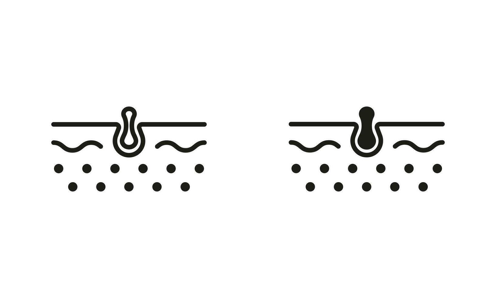 Blackhead Line and Silhouette Black Icon Set. Pimple and Inflammation Sebum Pictogram. Skin Acne, Comedo, Deep Pustule Skin Problem Symbol Collection. Isolated Vector Illustration.