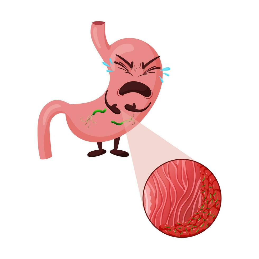 Crying cartoon stomach character with helicobacter pylori infection in mucosa layer under magnification vector