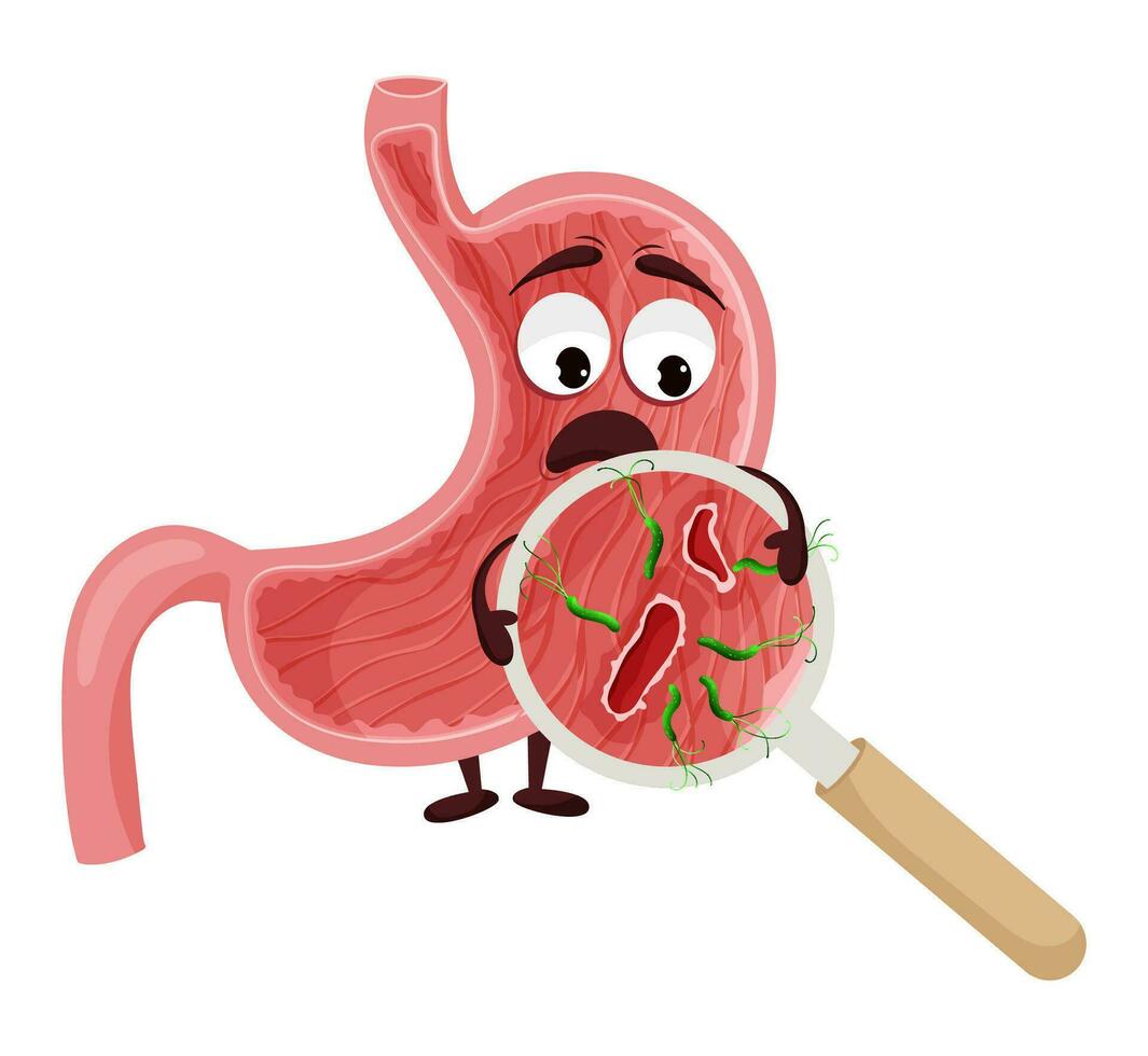 Cartoon stomach character with ulcer and helicobacter pylori infection under magnifying glass vector