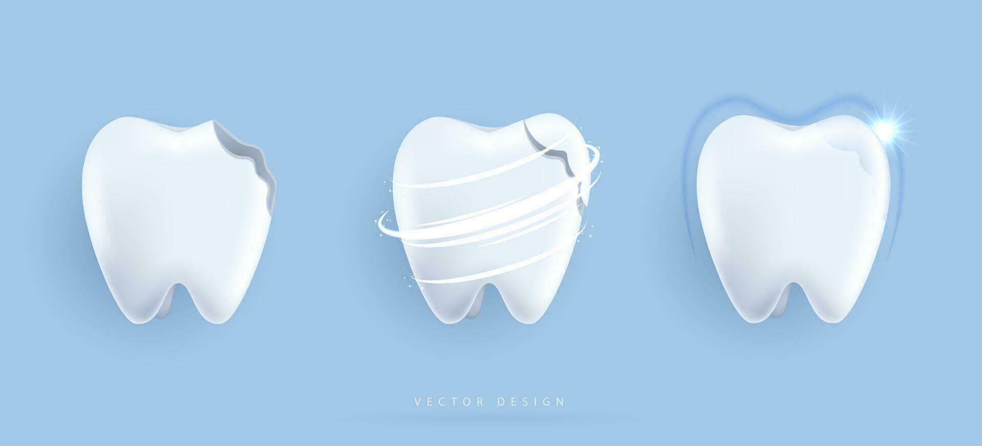 conjunto de dental limpieza y blanqueo dientes concepto. comparación de limpiar y sucio diente. dental salud y oral higiene póster para odontología. examen dientes, blanqueo y reparar. vector diseño.