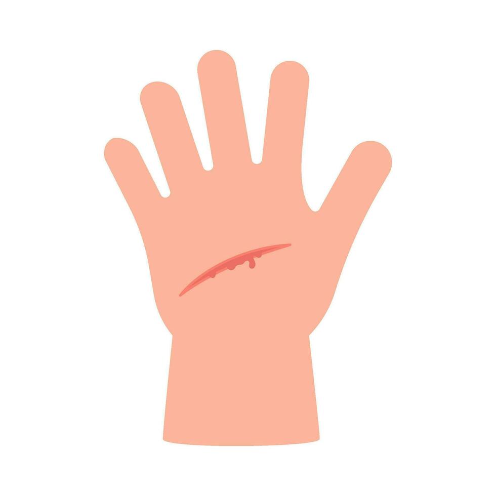 Wound of hand child skin, scratch. Cut injury skin, bleeding cut. Vector illustration