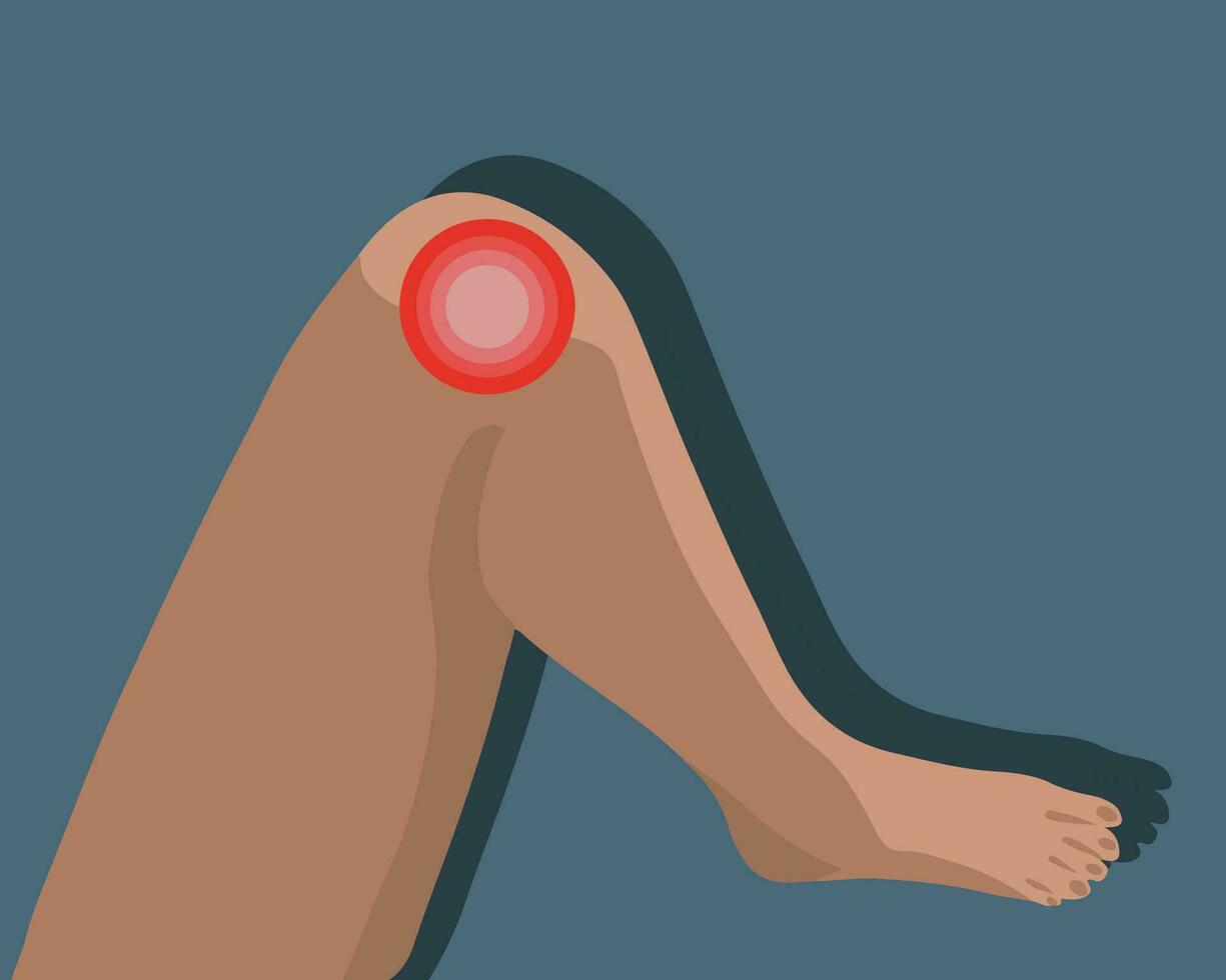 Vector isolated illustration of knee pain. Localization of knee pain.