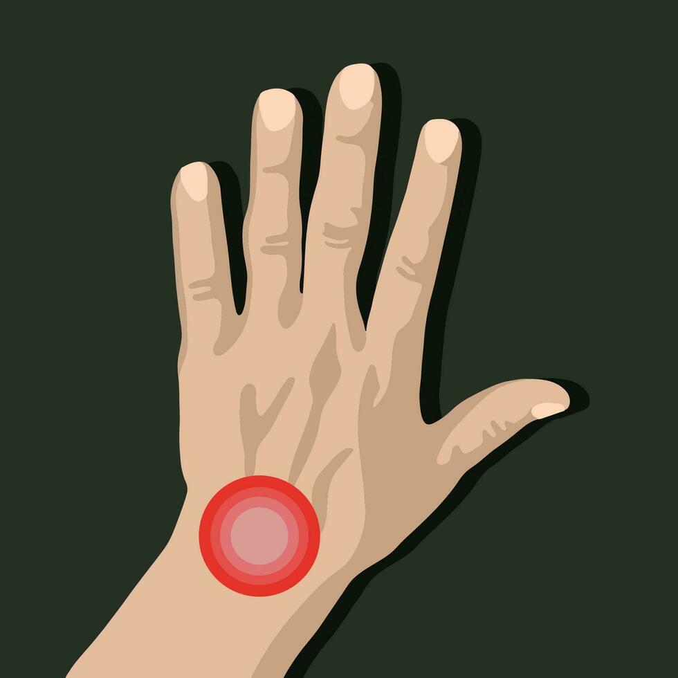 Vector isolated illustration of wrist pain. Hand with localization of pain in the wrist.