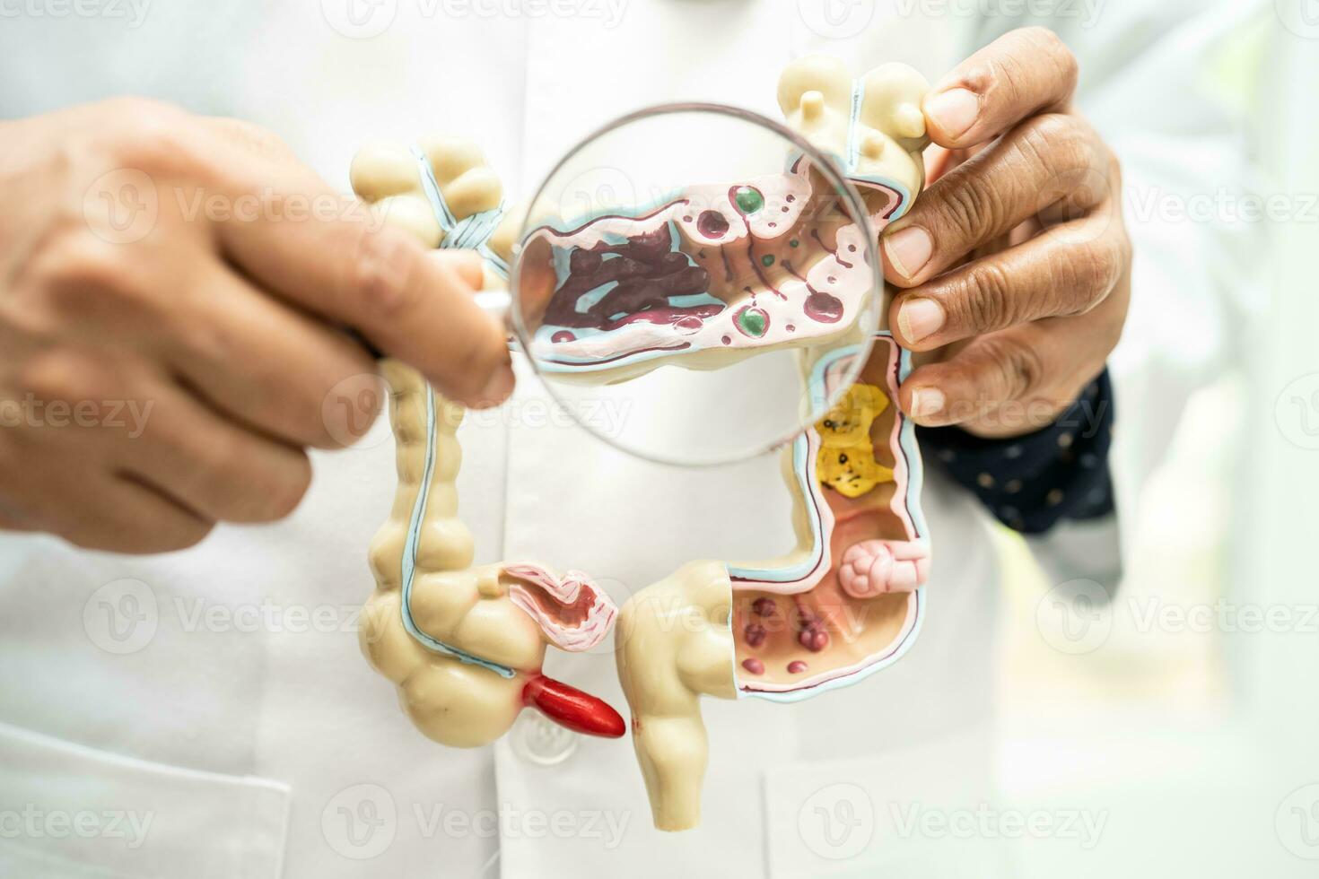 Intestine, appendix and digestive system, doctor holding anatomy model for study diagnosis and treatment in hospital. photo