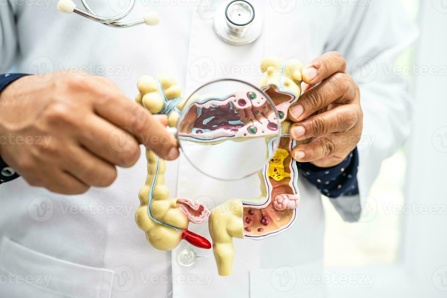 Intestine, appendix and digestive system, doctor holding anatomy model for study diagnosis and treatment in hospital. photo