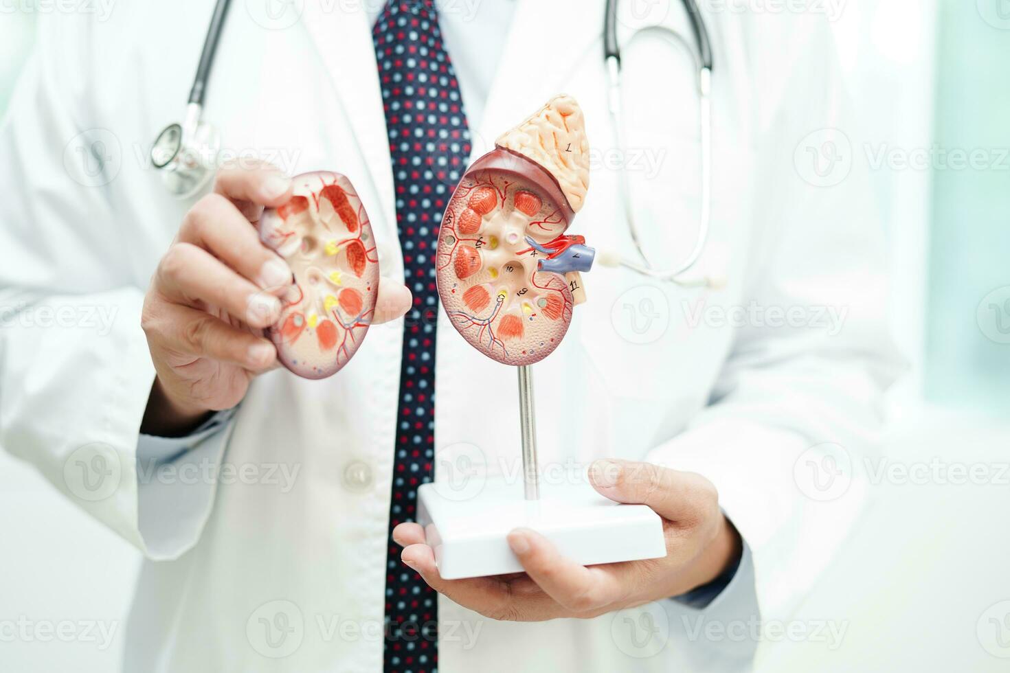 Chronic kidney disease, doctor with model for treatment urinary system, urology, Estimated glomerular filtration rate eGFR. photo