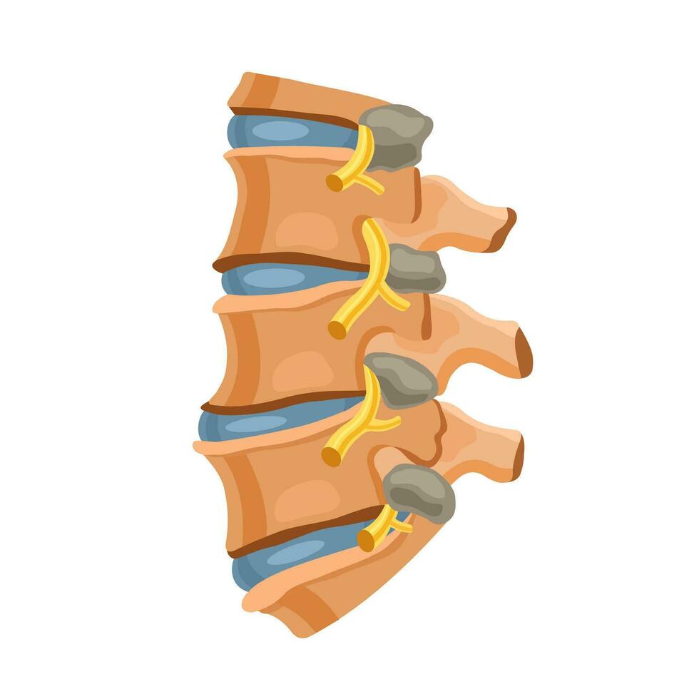 huesos de el columna vertebral. ortopedía. médico ilustración en un blanco antecedentes. vector