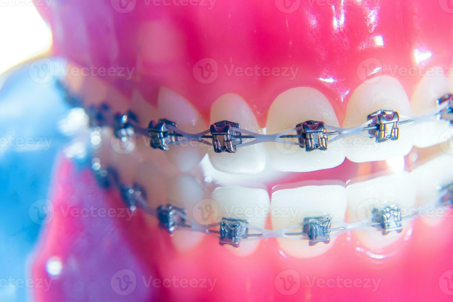 The braces are placed on the teeth in the artificial jaw. Macro photography photo