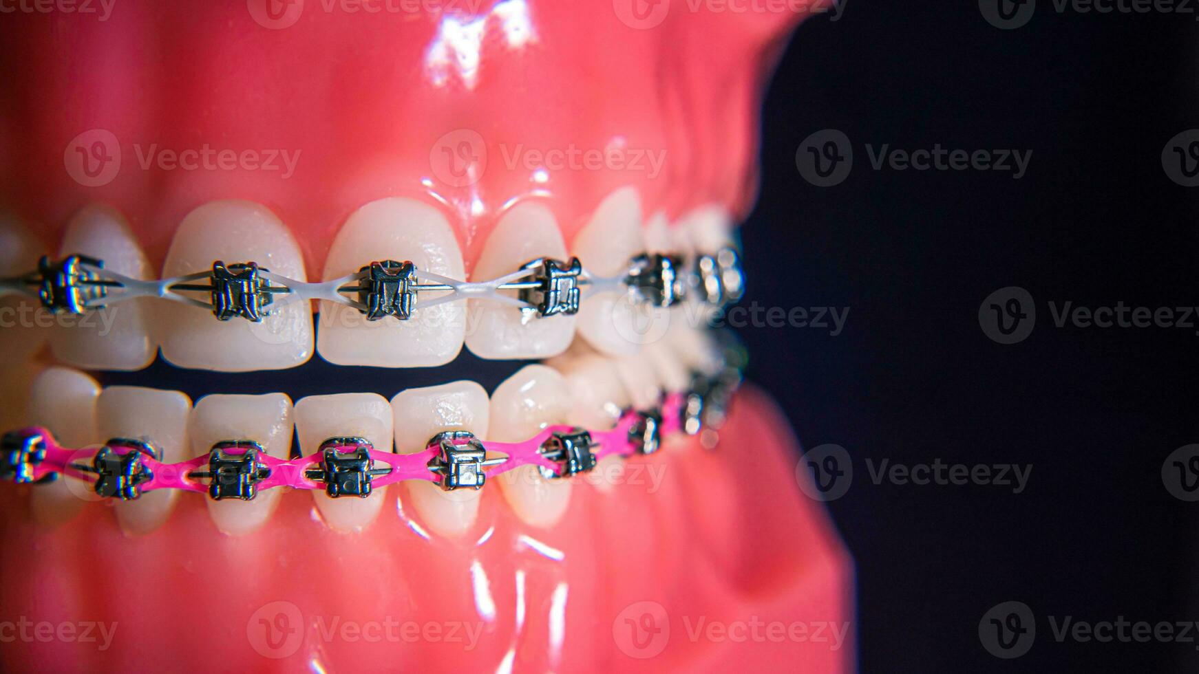 The braces are on the teeth in the artificial jaw on a black background. Macro photography photo