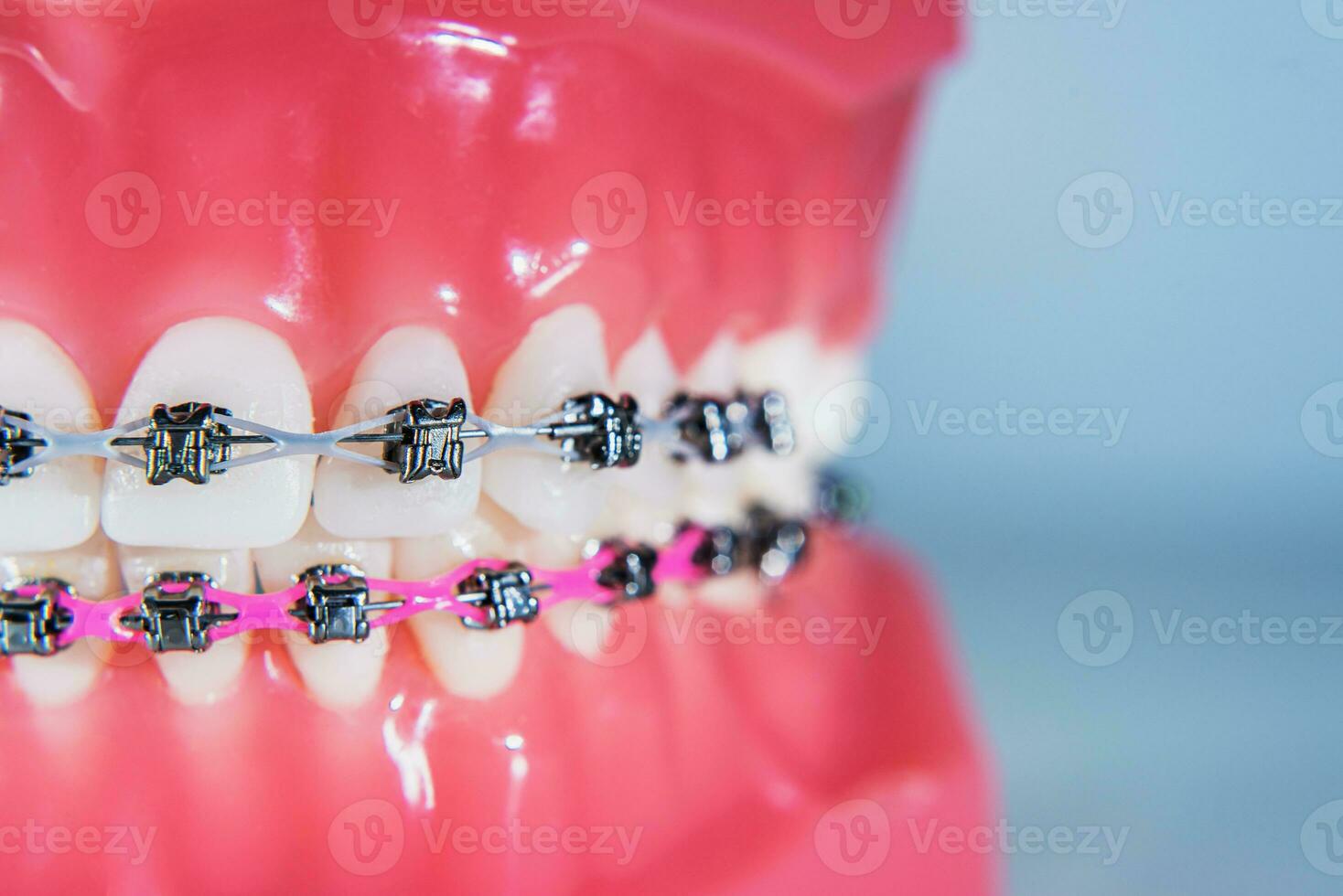 el tirantes son metido en el dientes en el artificial mandíbula. macro fotografía foto