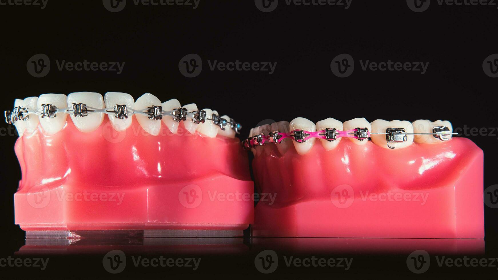 The braces are on the teeth in the artificial jaw on a black background. Macro photography photo