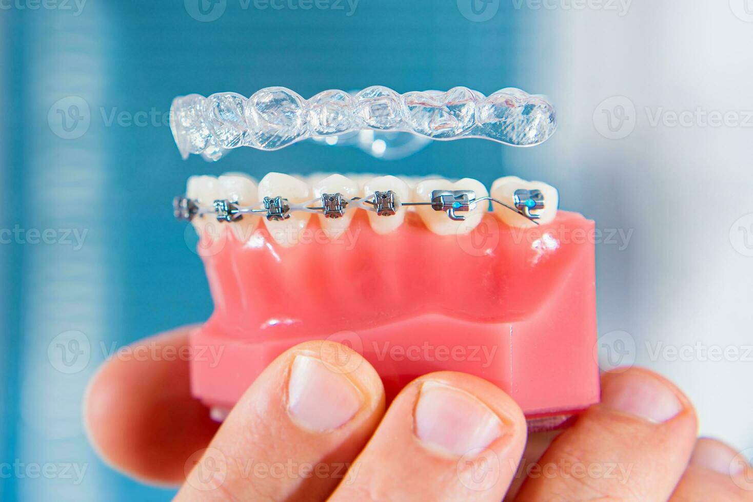 Dental care.Smiling orthodontist doctor holding aligners and braces in hand shows the difference between them photo