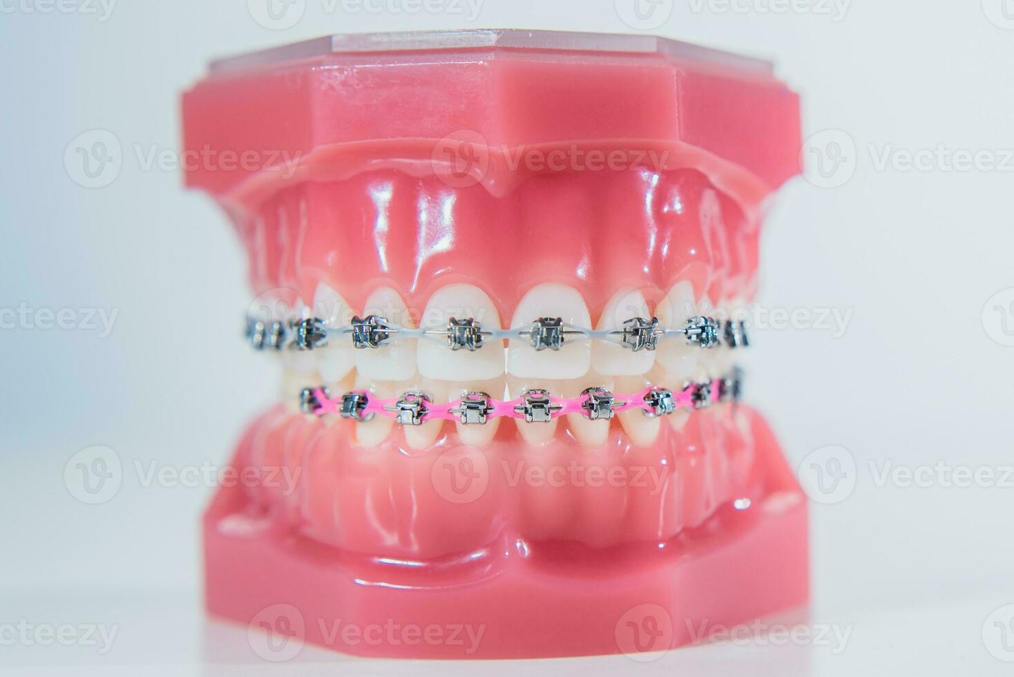 The braces are placed on the teeth in the artificial jaw on a white background. Macro photography photo