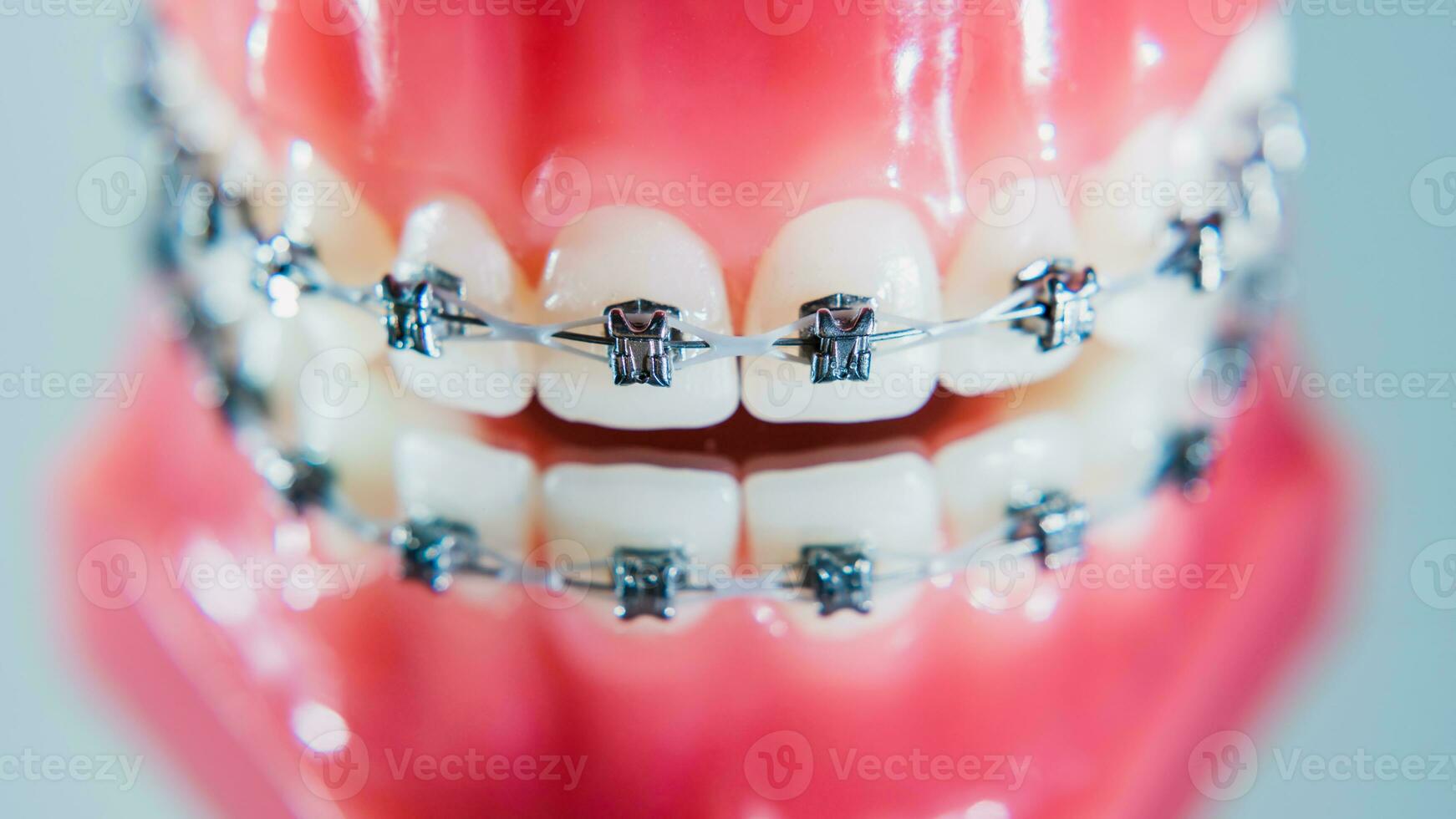 The braces are placed on the teeth in the artificial jaw. Macro photography photo