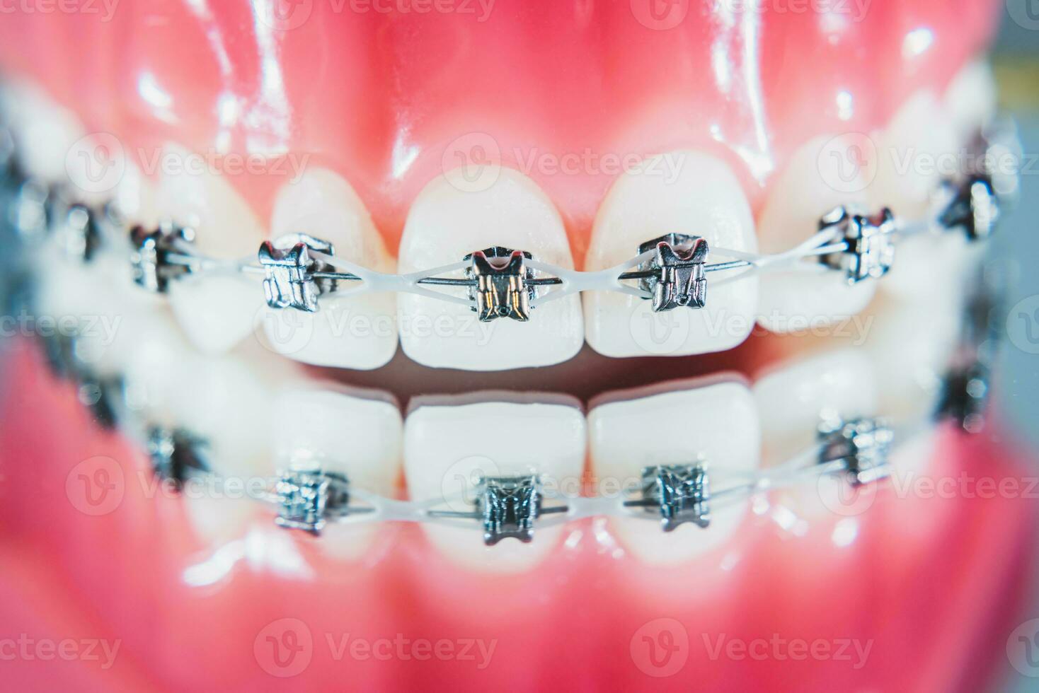 The braces are placed on the teeth in the artificial jaw. Macro photography photo