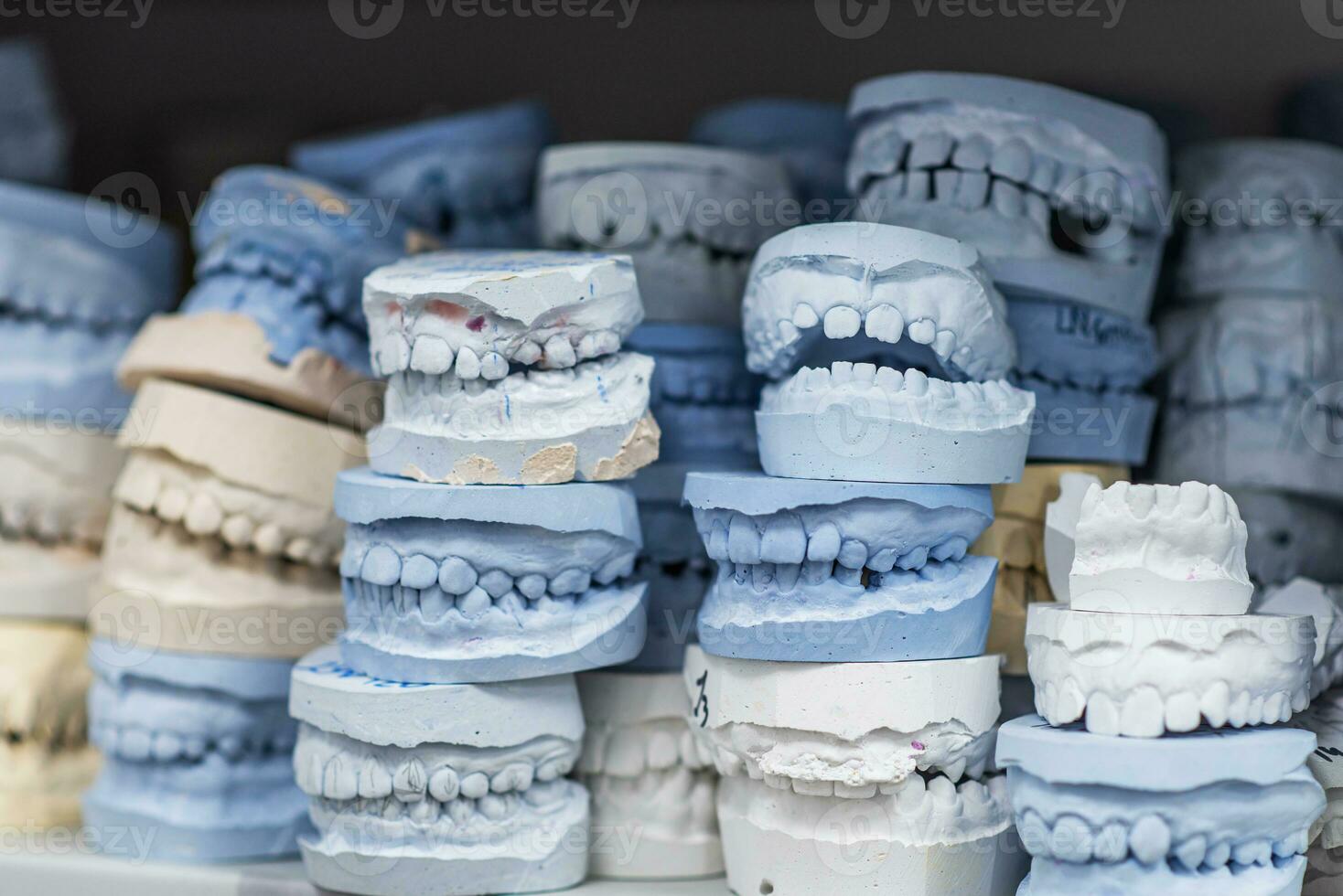 Warehouse of plaster models of human jaws in an orthodontic clinic. Control and diagnostic dental casts for aligners. photo