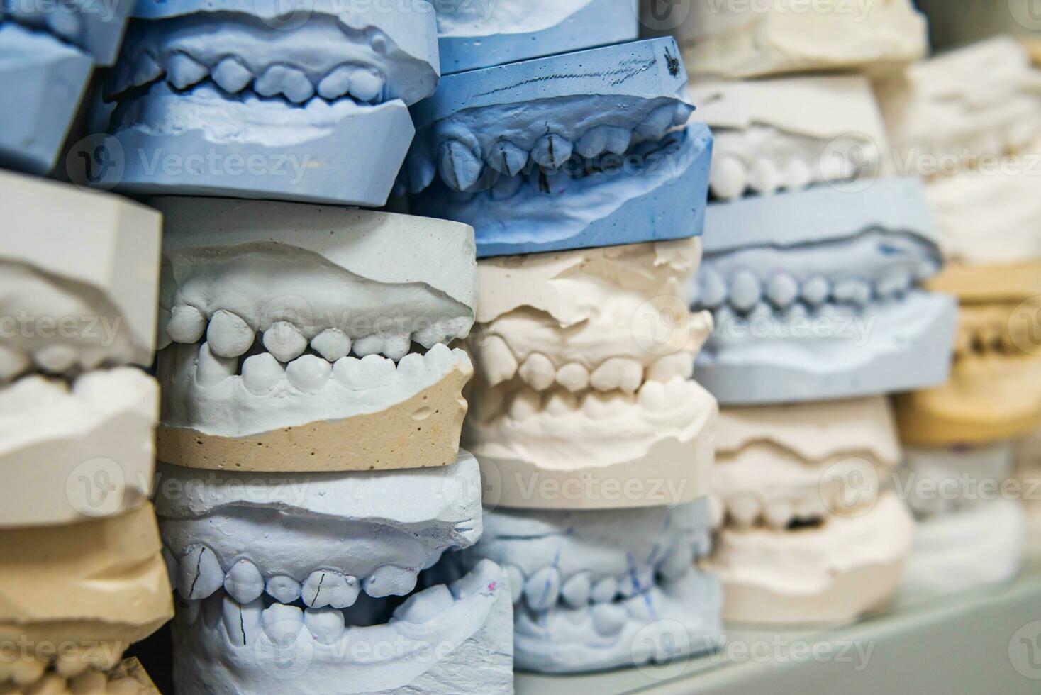 Warehouse of plaster models of human jaws in an orthodontic clinic. Control and diagnostic dental casts for aligners. photo