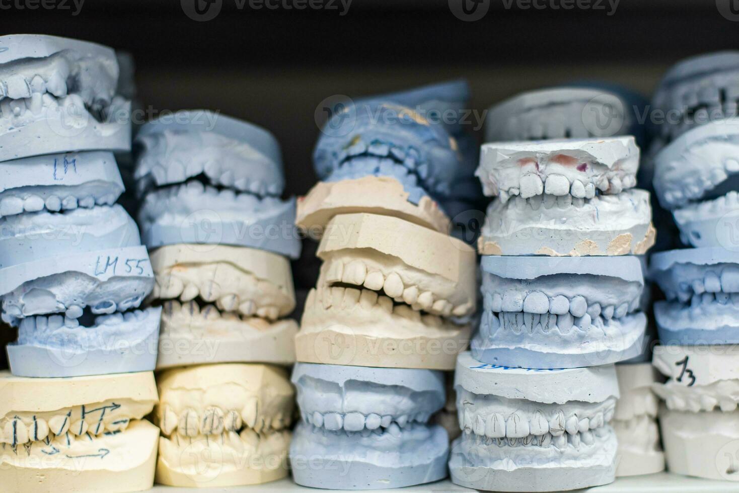 Warehouse of plaster models of human jaws in an orthodontic clinic. Control and diagnostic dental casts for aligners. photo