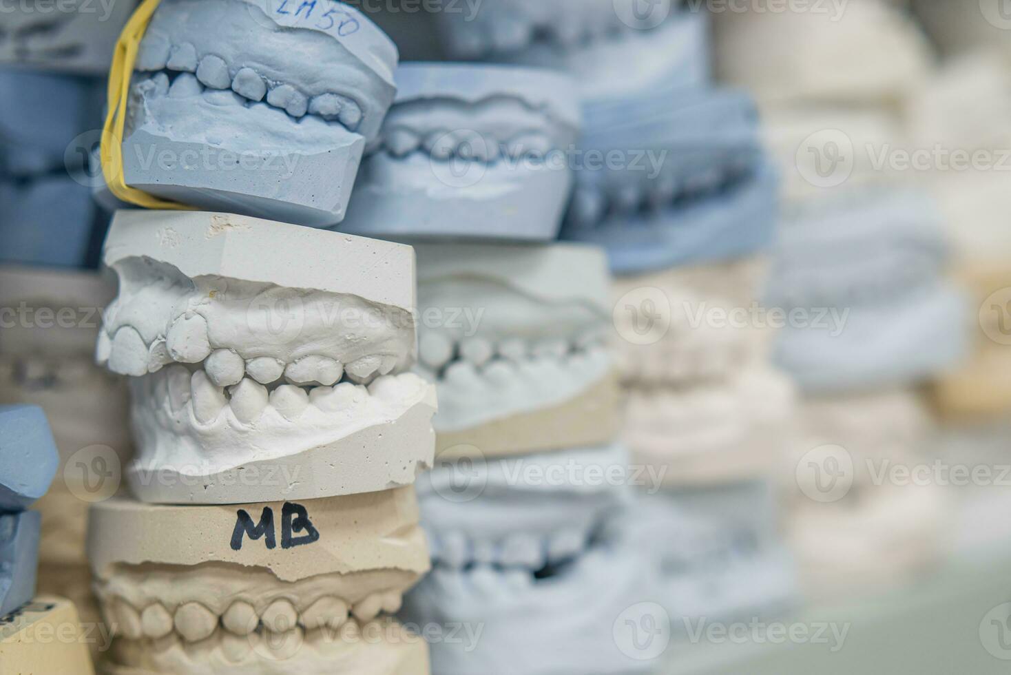 almacén de yeso modelos de humano mandíbulas en un ortodoncia clínica. controlar y diagnóstico dental yesos para alineadores. foto