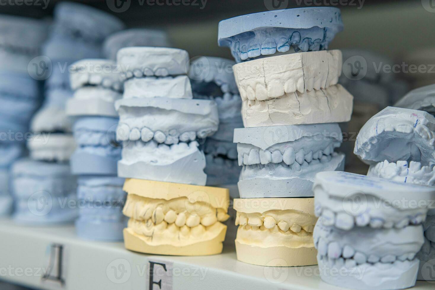 almacén de yeso modelos de humano mandíbulas en un ortodoncia clínica. controlar y diagnóstico dental yesos para alineadores. foto