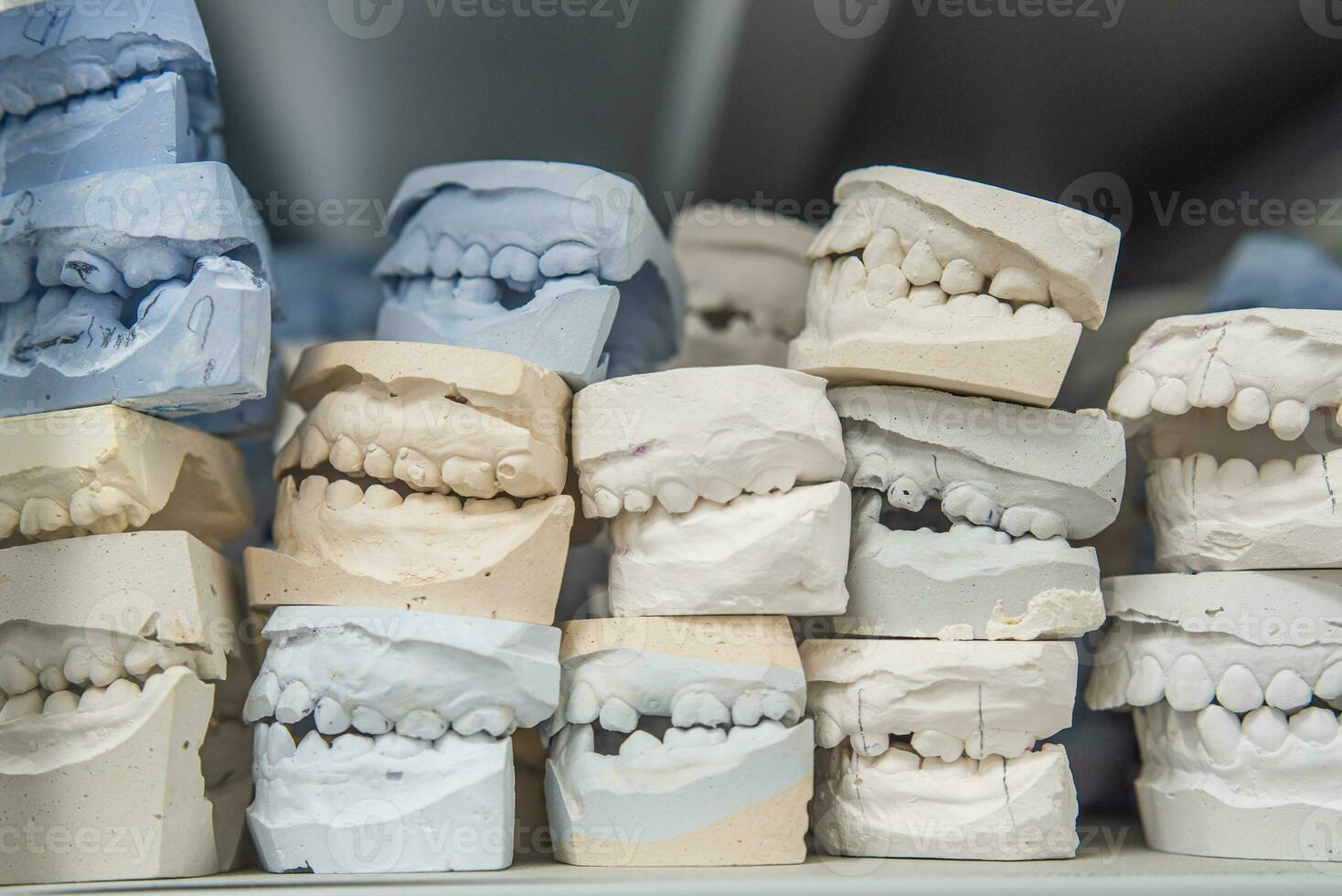 Warehouse of plaster models of human jaws in an orthodontic clinic. Control and diagnostic dental casts for aligners. photo